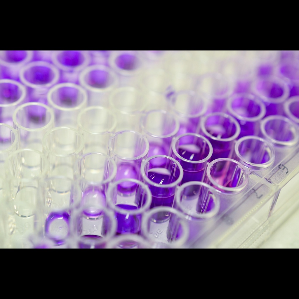 Mouse HCy Homocysteine  ELISA Kit, 96 Tests